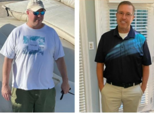 before and after photos