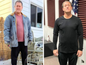 before and after photo