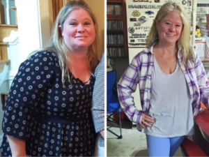 before and after weight loss photos