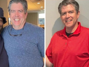 before and after