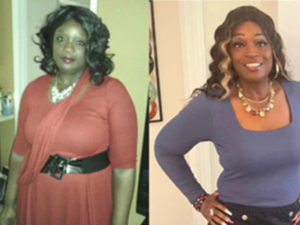 before and after weight loss photos