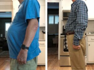 before and after weight loss photos