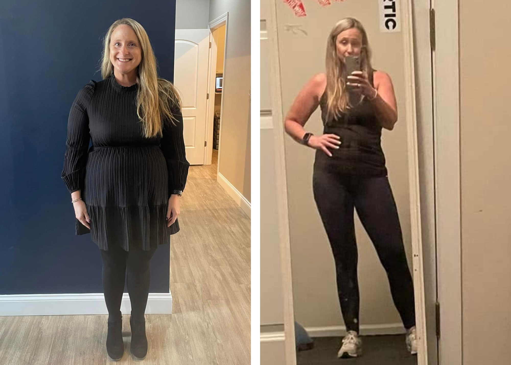 Catherine M. before and after