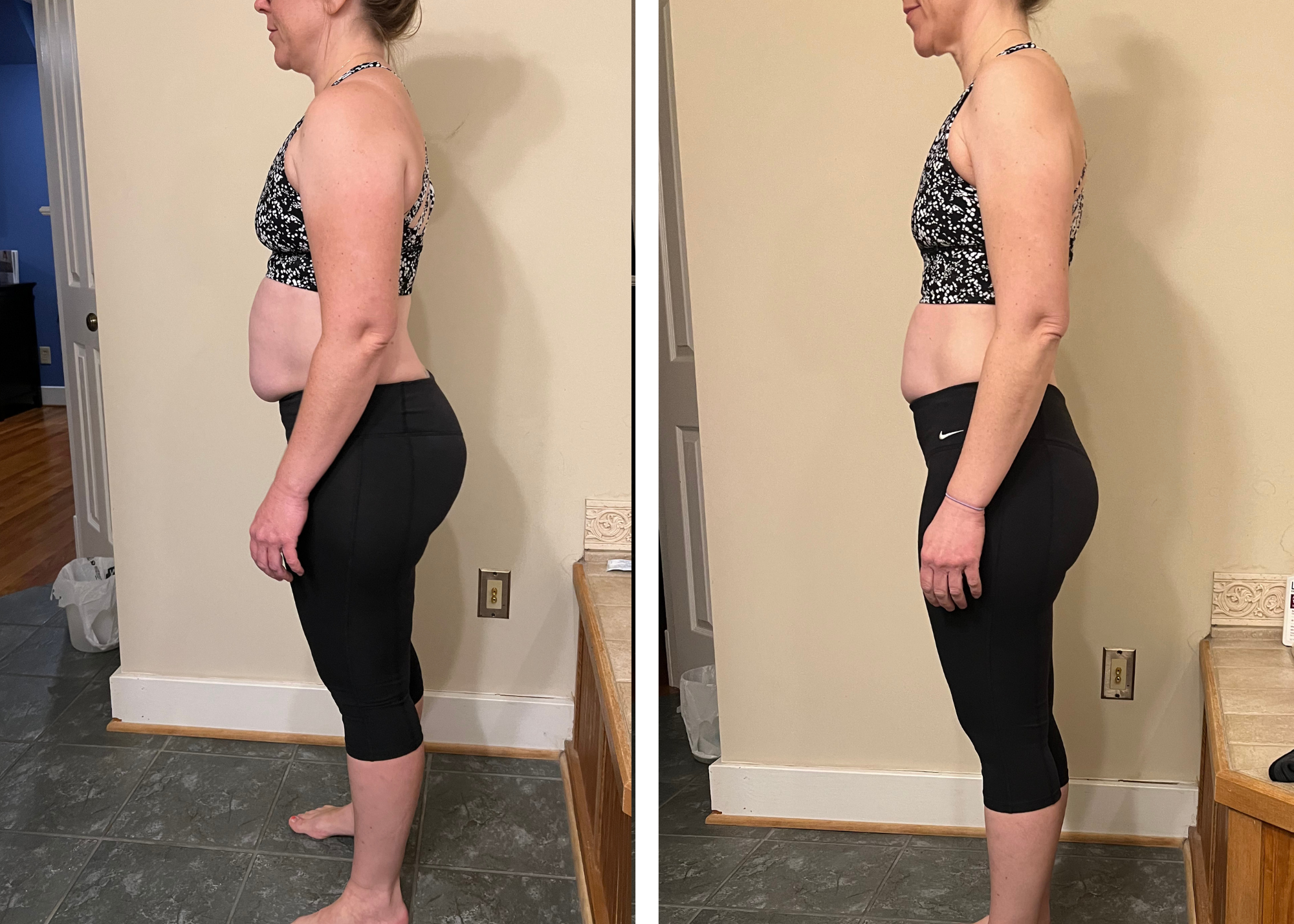 Dawn M. before and after