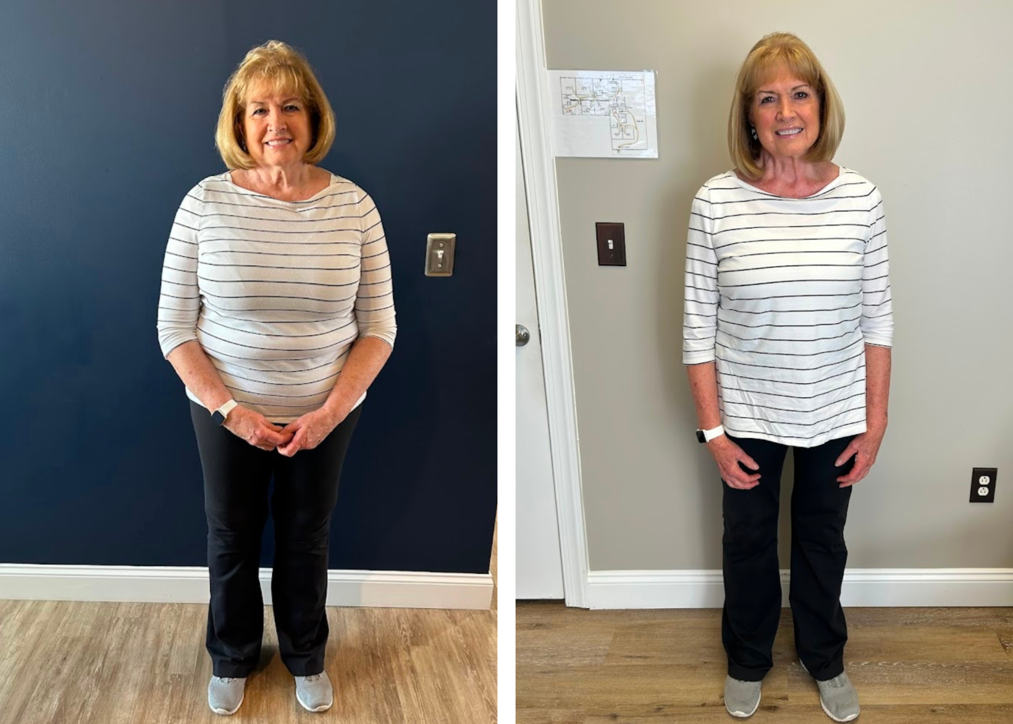 Kathleen G. before and after