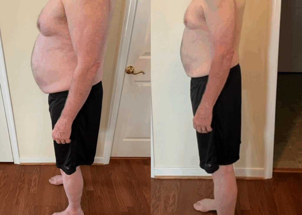 Man facing left showing his upper body before and after having lost 30 pounds in 60 days