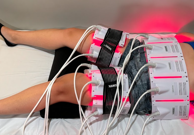 Invisa RED Thigh Lipo Laser Treatment