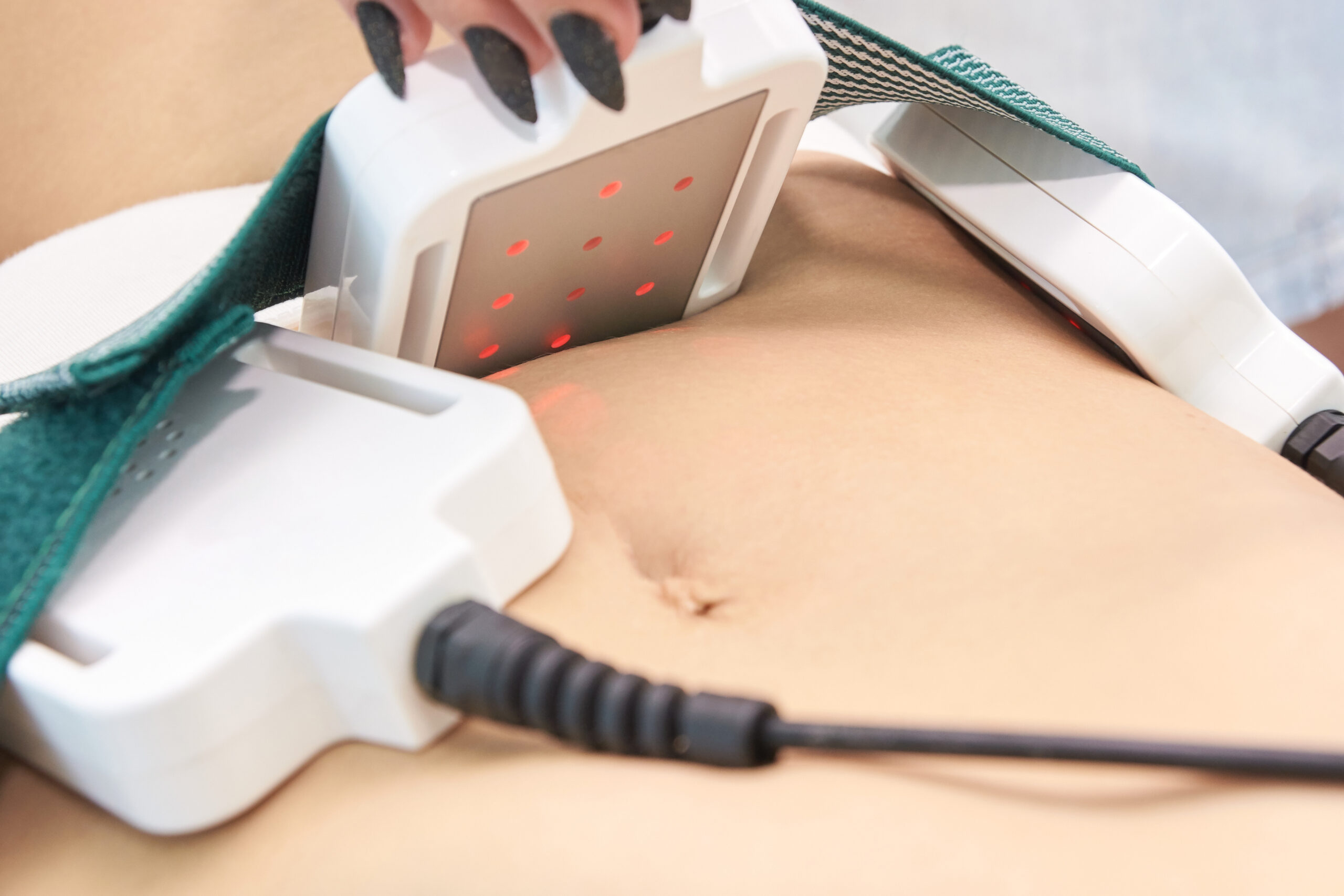 laser body contouring